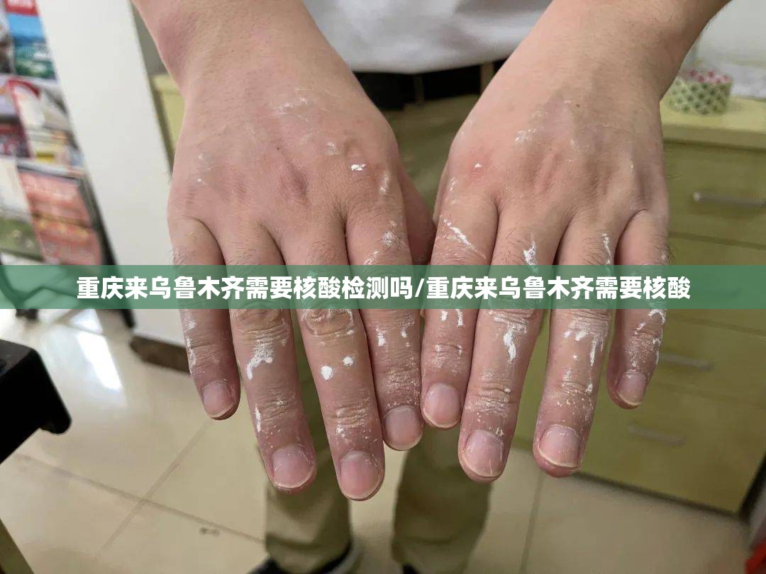 重庆来乌鲁木齐需要核酸检测吗/重庆来乌鲁木齐需要核酸