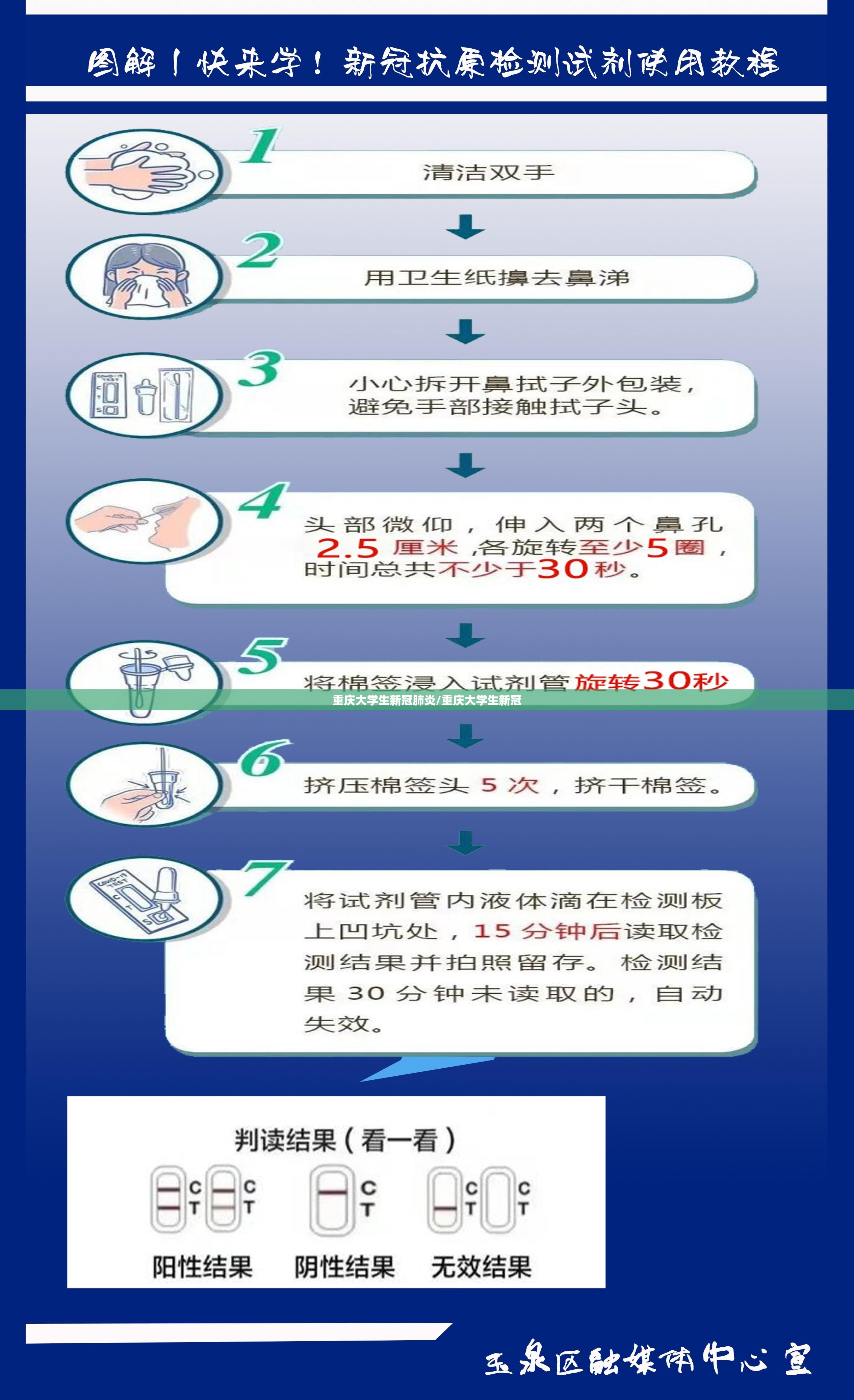 重庆大学生新冠肺炎/重庆大学生新冠